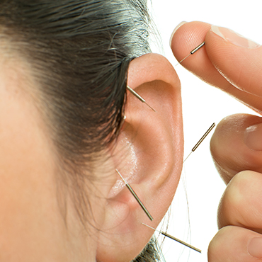 Acupuncture Image - 